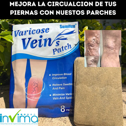 Por fin podras eliminar las horribles varices